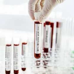 Gloved hand holding vials of blood for testing