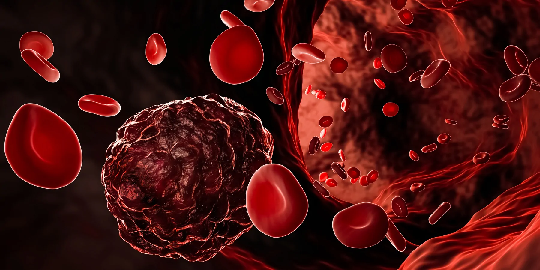 Researchers Discover Genes That Predict Good Response to Blood Cancer Therapy Computer render of blood cells and cancer cells in the blood stream