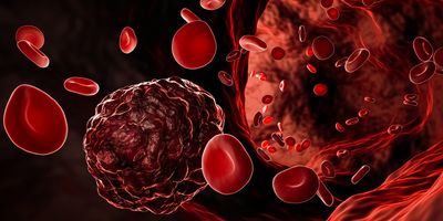 Computer render of blood cells and cancer cells in the blood stream