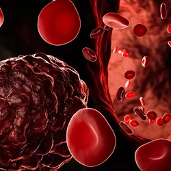 Computer render of blood cells and cancer cells in the blood stream