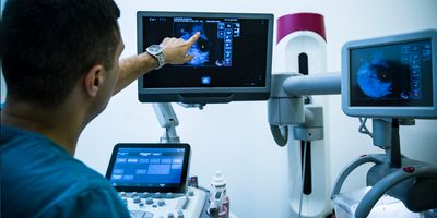 Doctor pointing to a mammogram