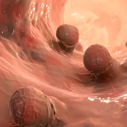 Computer image of cancer polyps