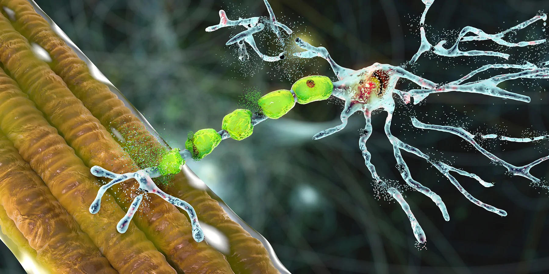 Computer render of a motor neuron degenerating