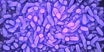 SEM image of bacteria stained purple
