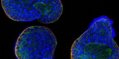 Immunofluorescence image obtained after thawing and immunostaining human airway organoids with for DAPI (nucleic acid stain; blue), KRT5 (basal cell marker, red) and phalloidin (F-Actin, green).