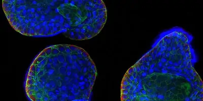 Immunofluorescence image obtained after thawing and immunostaining human airway organoids with for DAPI (nucleic acid stain; blue), KRT5 (basal cell marker, red) and phalloidin (F-Actin, green).