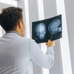 Doctor looking at CT scan of patient's head