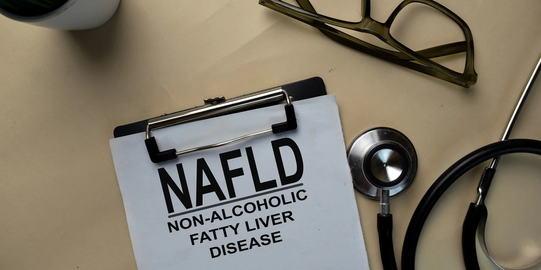 NAFLD - Non-Alcoholic Fatty Liver Disease write on a paperwork isolated on office desk