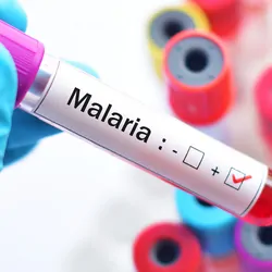 Gloved hand holding a blood vial labeled as malaria positive
