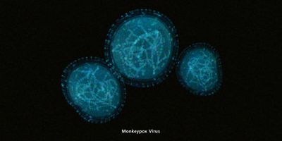 Image of the monkey pox virus
