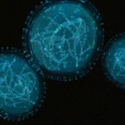 Image of the monkey pox virus