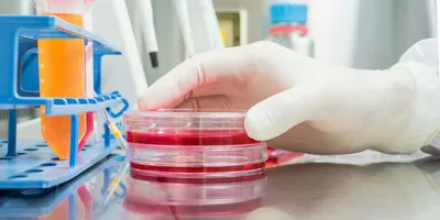 Photo of a clinical professional reaching into a BSC to culture cell therapies.