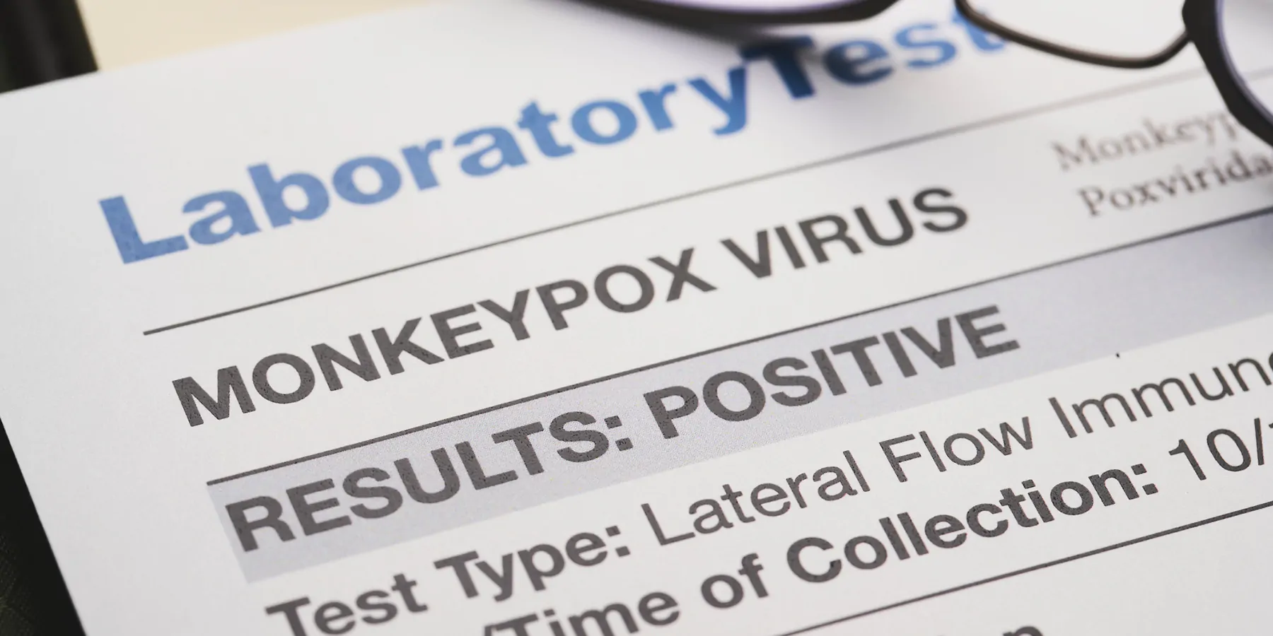 Labcorp to Begin Monkeypox Testing Today, Doubling Nationwide Testing Capacity Monkeypox virus test results document