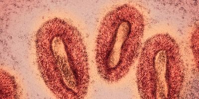 Colored visualization of monkeypox virus electron microscopy photo.