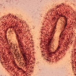 Colored visualization of monkeypox virus electron microscopy photo.