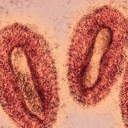 Colored visualization of monkeypox virus electron microscopy photo.