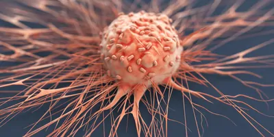 Computer render of human cancer cell