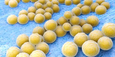 Digital image of Staphylococcus aureus