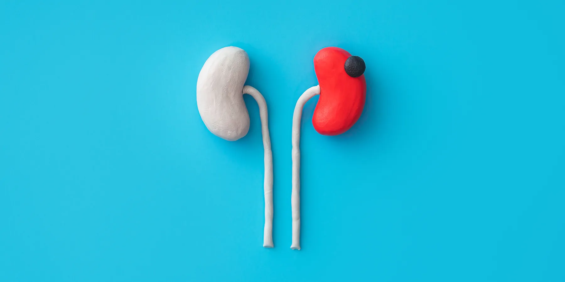 Kidneys made out of clay where one is healthy and one is sick