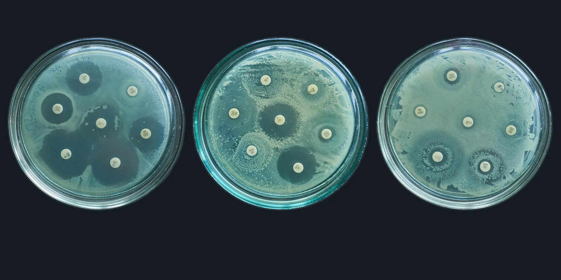 kirby bauer method. Antibiotic Sensitivity Test on a black background