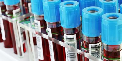 Blood test tubes, blue topped