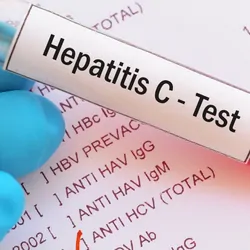 Test tube with blood sample for hepatitis C virus
