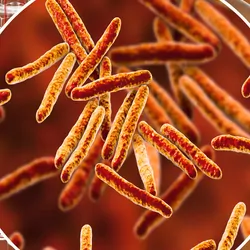 Secondary tuberculosis in lungs and close-up view of Mycobacterium tuberculosis bacteria, 3D illustration