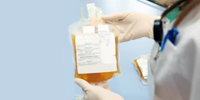 Doctor in a blood bank is holding blood bag with red blood cells