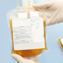 Doctor in a blood bank is holding blood bag with red blood cells
