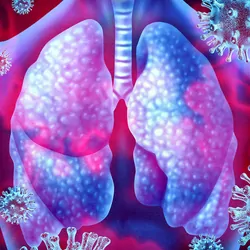 Concept art of viruses in the lungs, depicting the prevalence of viral respiratory illness requiring molecular diagnostics.