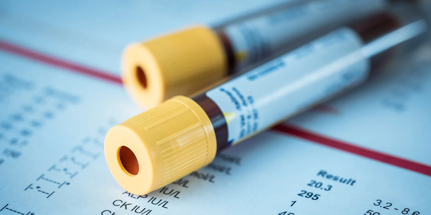 Blood Test, Label, Tube, Tubing