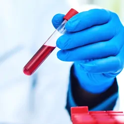 Closeup shot of a scientist analyzing samples in a laboratory