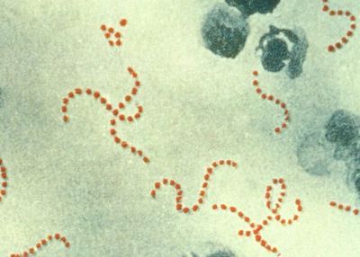 Global Strep A Vaccine One Step Closer