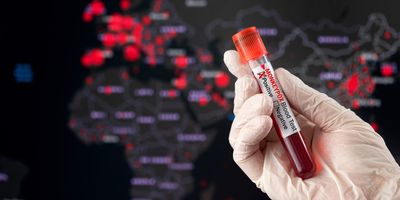 Monkeypox positive blood tube and world pandemic map