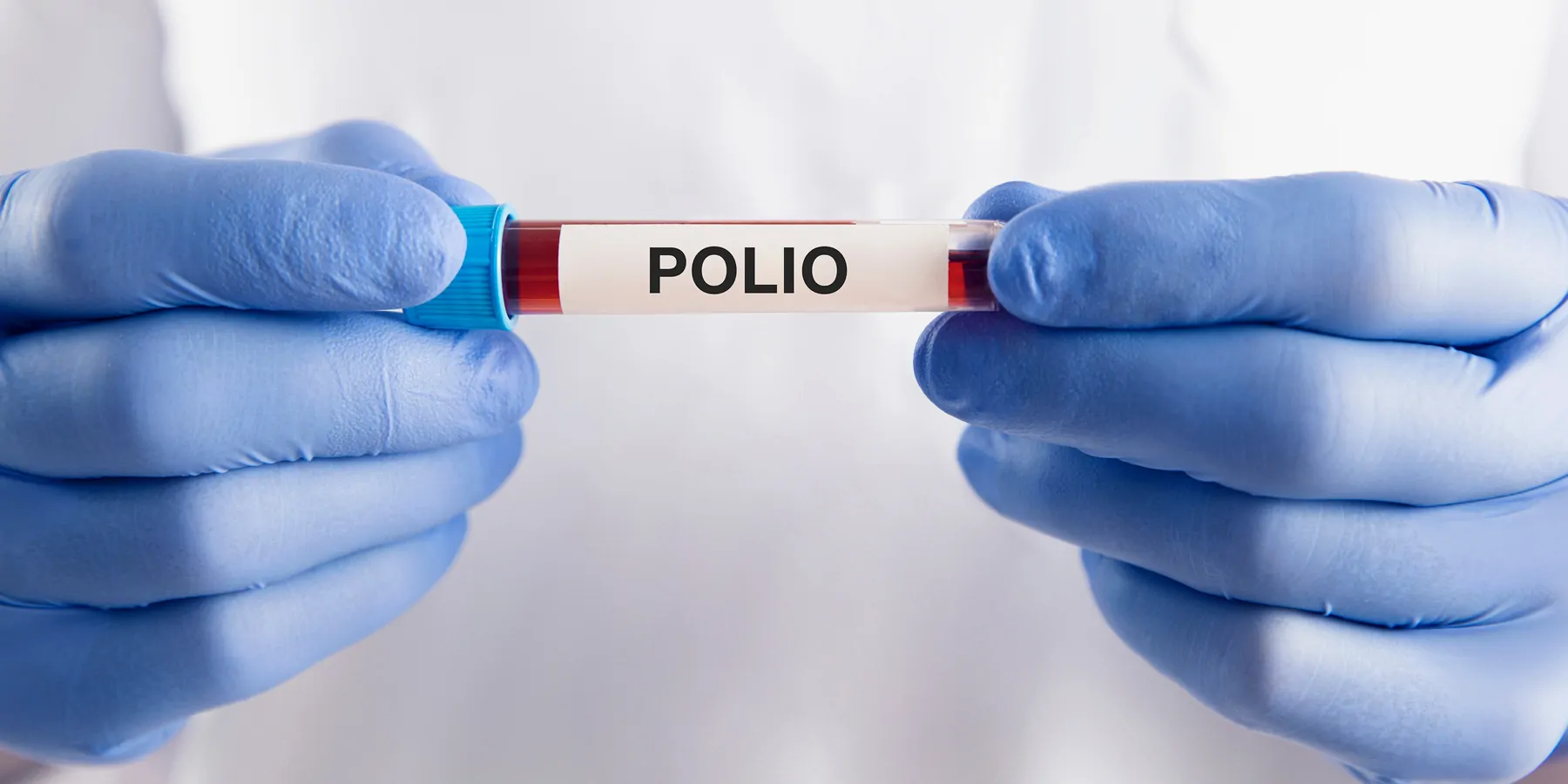 United States Confirmed as Country with Circulating Vaccine-Derived Poliovirus Vial labled polio being held by a person wearing PPE