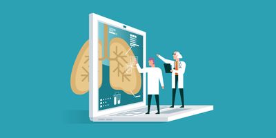 Illustration of two clinical lab personnel viewing the lung through a computer analytics screen, representing cancer diagnostics for EGFR variants implicated in non-small cell lung cancer (NSCLC).