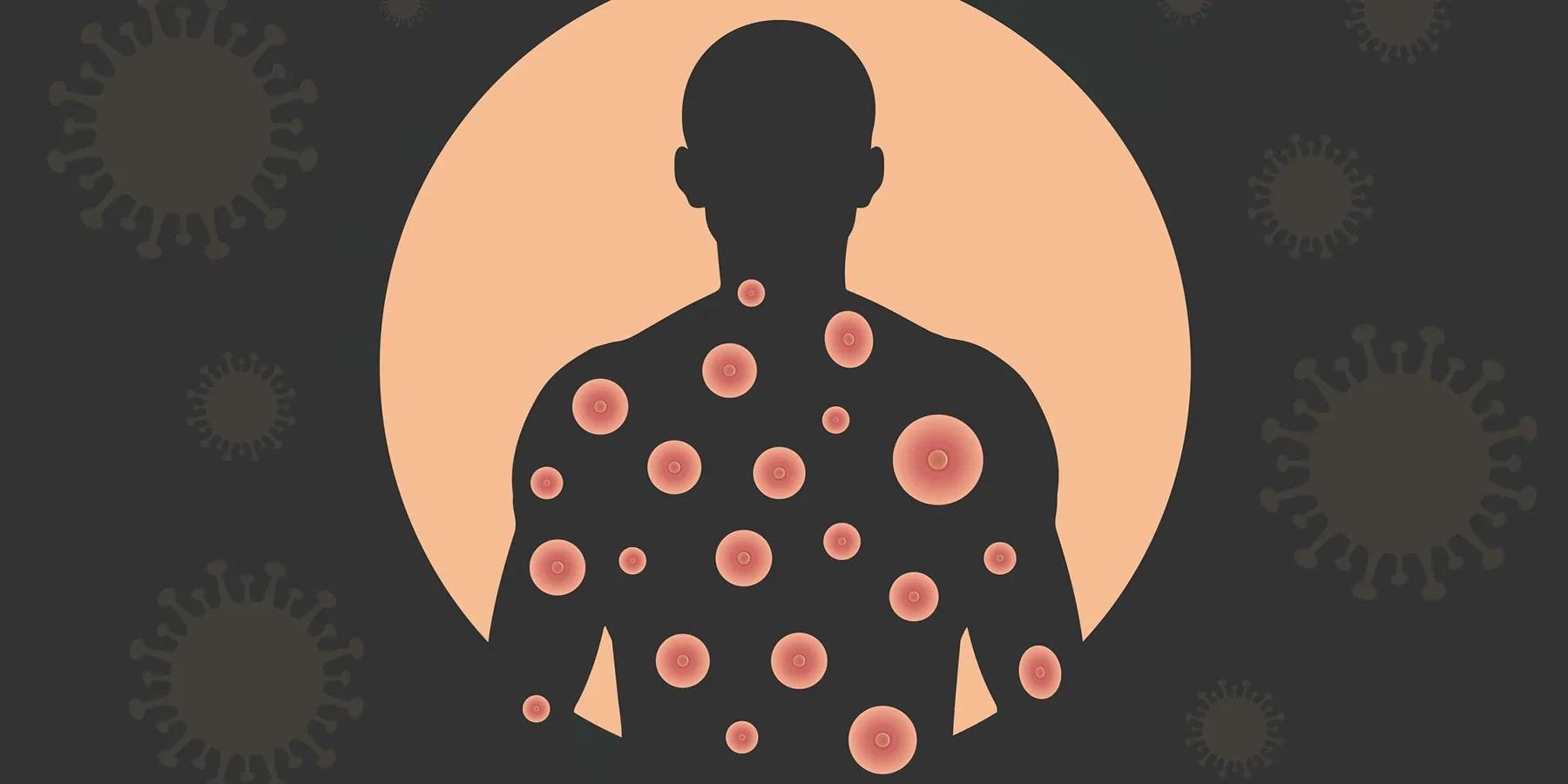 Banner of monkeypox virus on black background