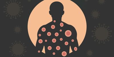 Banner of monkeypox virus on black background