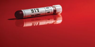 Photograph of a HIV blood test sample tube.