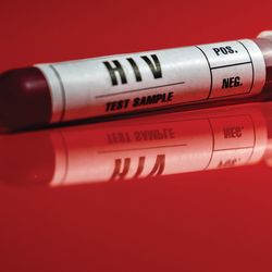 Photograph of a HIV blood test sample tube.