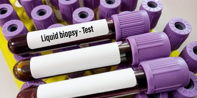 Blood samples in tubes labeled for liquid biopsy