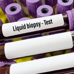 Blood samples in tubes labeled for liquid biopsy