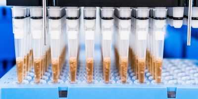 Pipette automation in the lab, Next-generation sequencing