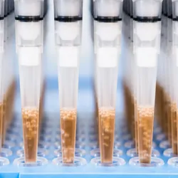 Pipette automation in the lab, Next-generation sequencing