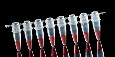 Photo of droplet digital PCR tubes against a black background.