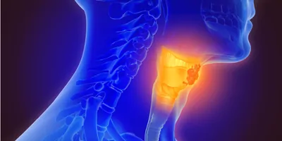 Computer render of a human throat with the vocal cords glowing