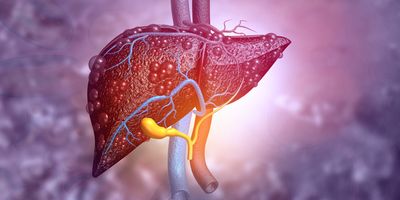 Computer image of diseased liver