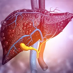 Computer image of diseased liver