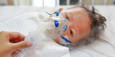 Photograph of baby with an inhalation mask as they are being treated for respiratory syncytial virus (RSV) at a hospital.