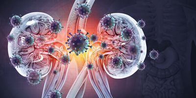 Computer image of kidney disease around kidneys